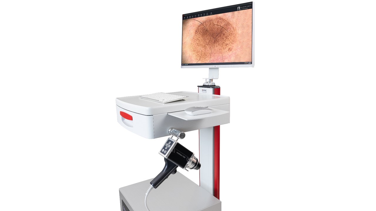 FotoFinder Vexia 1000 Digital Dermatoscopy System