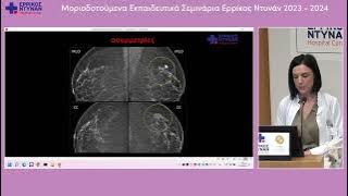 ΓΚΑΛΗ-20240528