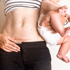 Mommy Makeover – Νέες μητέρες με σφριγηλό, ανανεωμένο σώμα μετά την εγκυμοσύνη