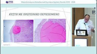 ΠΕΤΡΟΛΕΚΑΣ-20260310